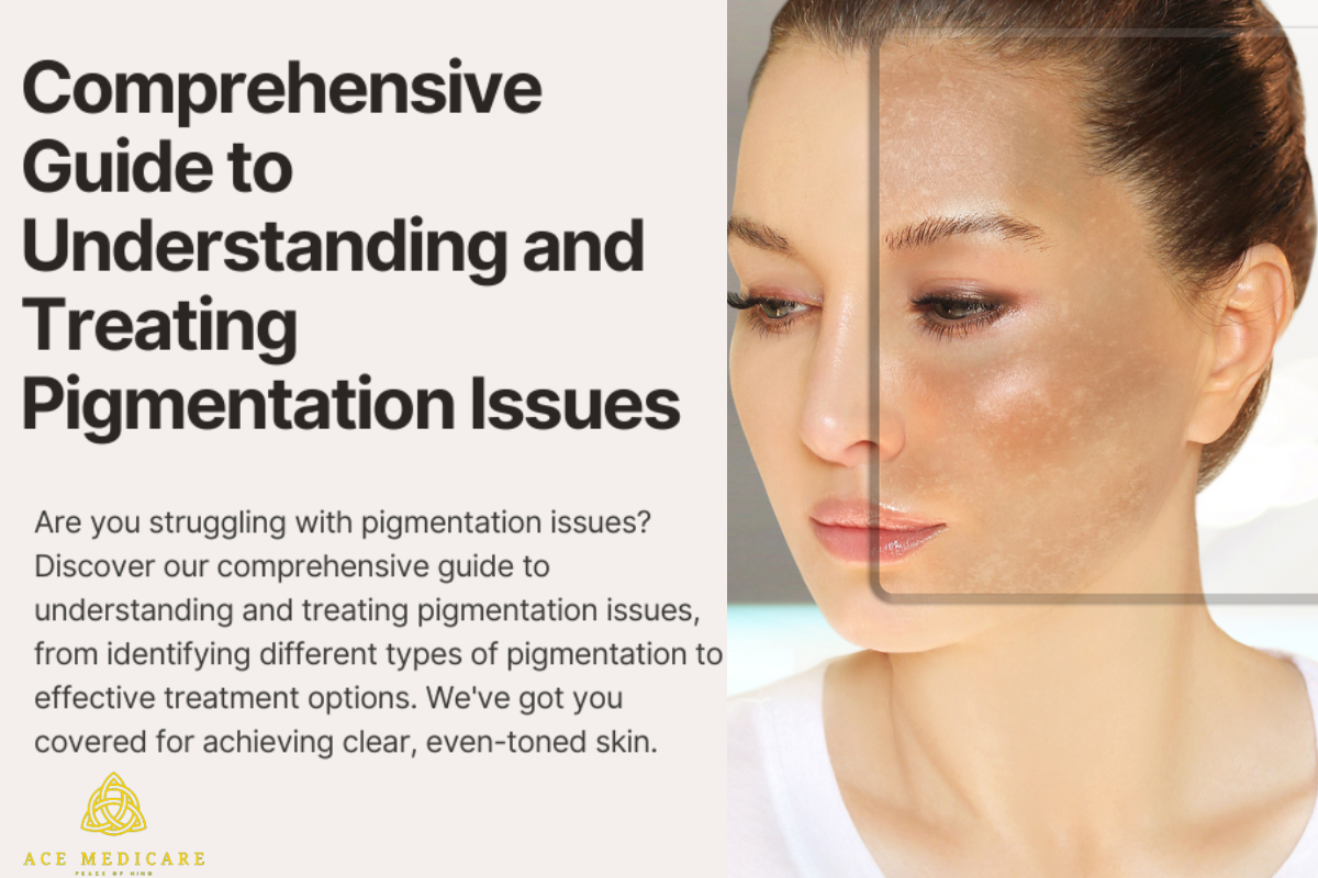 The Ultimate Guide to Understanding Skin Pigmentation